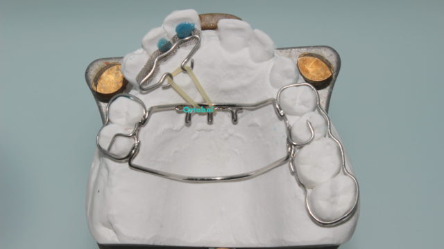 ortodonzia-segmentata